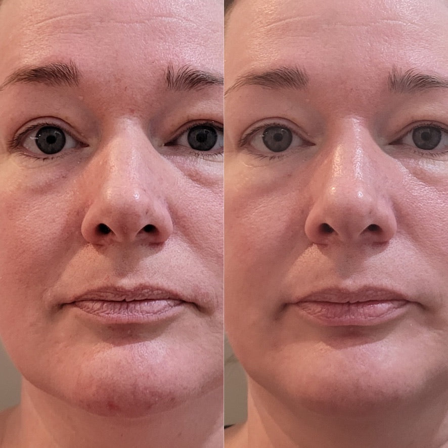 Collagen Cream Moisturizer