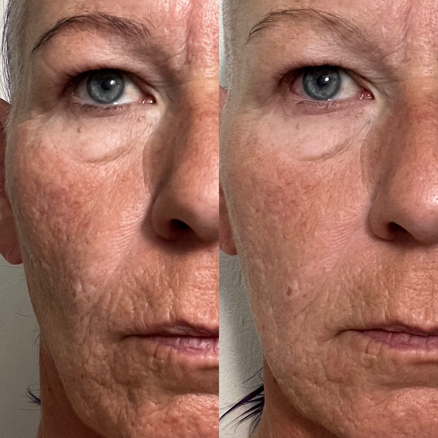 Collagen Cream Moisturizer
