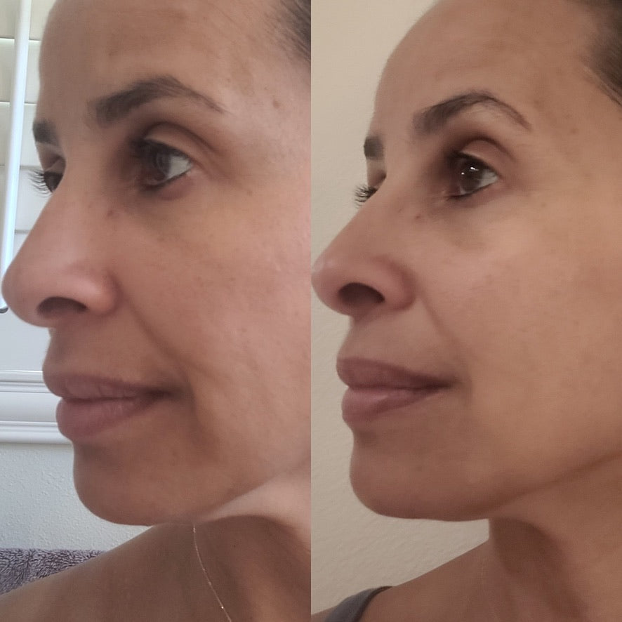 Collagen Cream Moisturizer