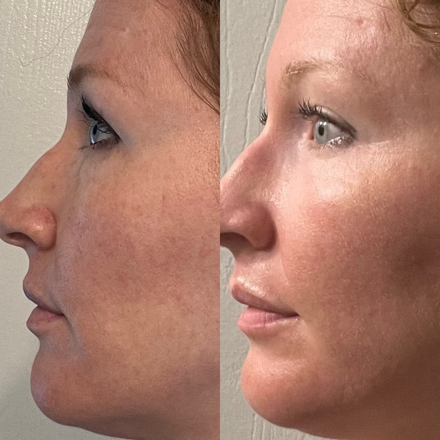 Collagen Cream Moisturizer
