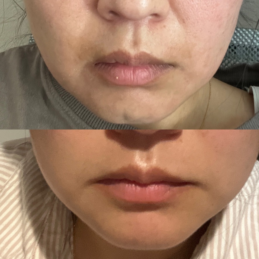 Ceru Blue Barrier Balm