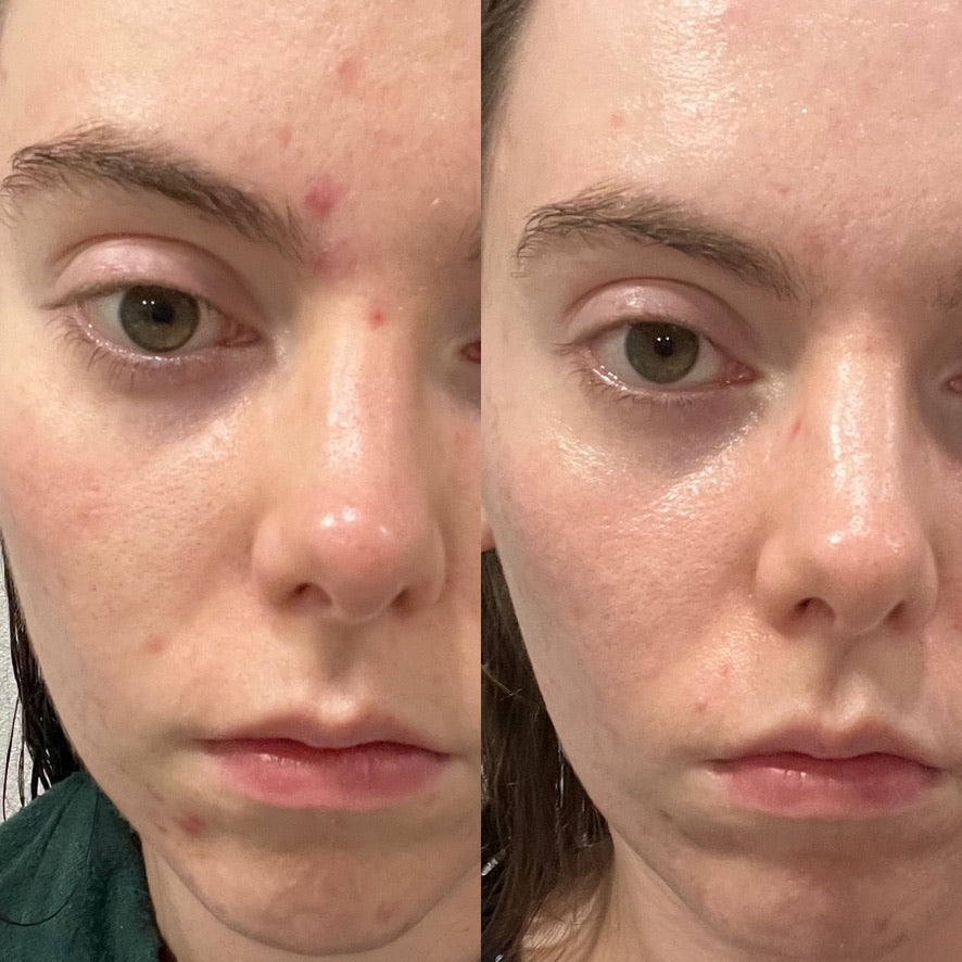 Holy GOAT Clarity Serum