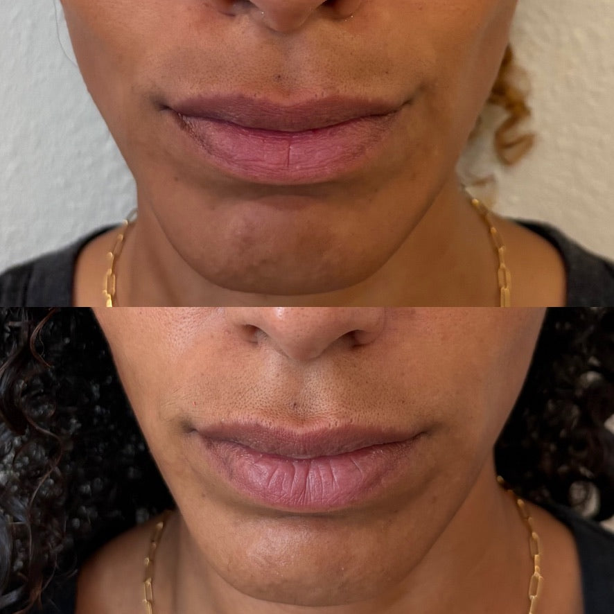 Holy GOAT Clarity Serum