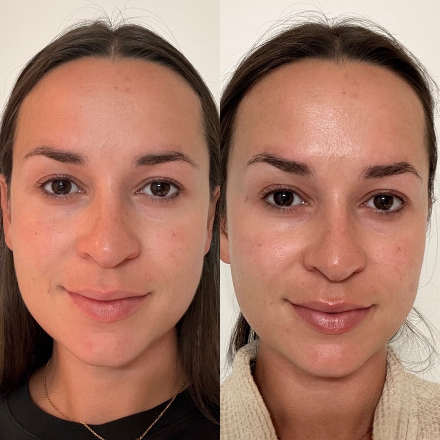 Holy GOAT Clarity Serum