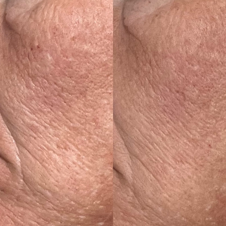 Collagen Cream Moisturizer