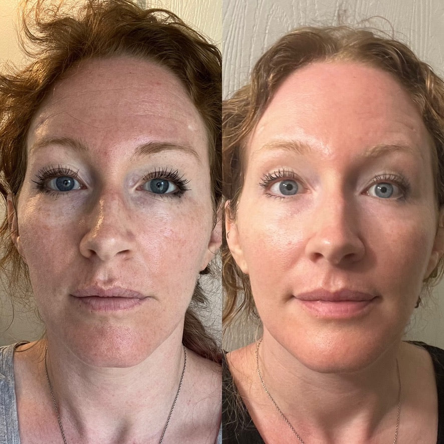 Collagen Cream Moisturizer