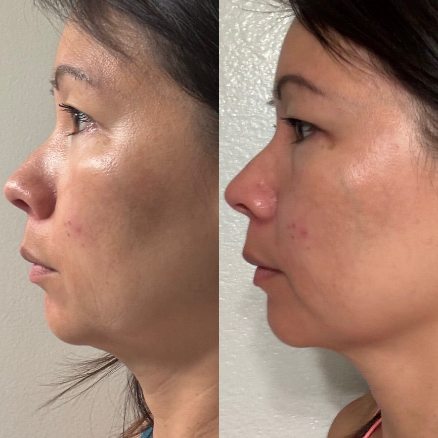Collagen Cream Moisturizer