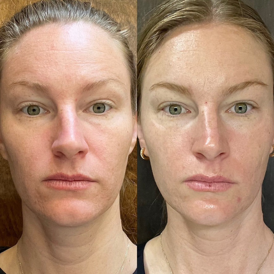 Holy GOAT Clarity Serum