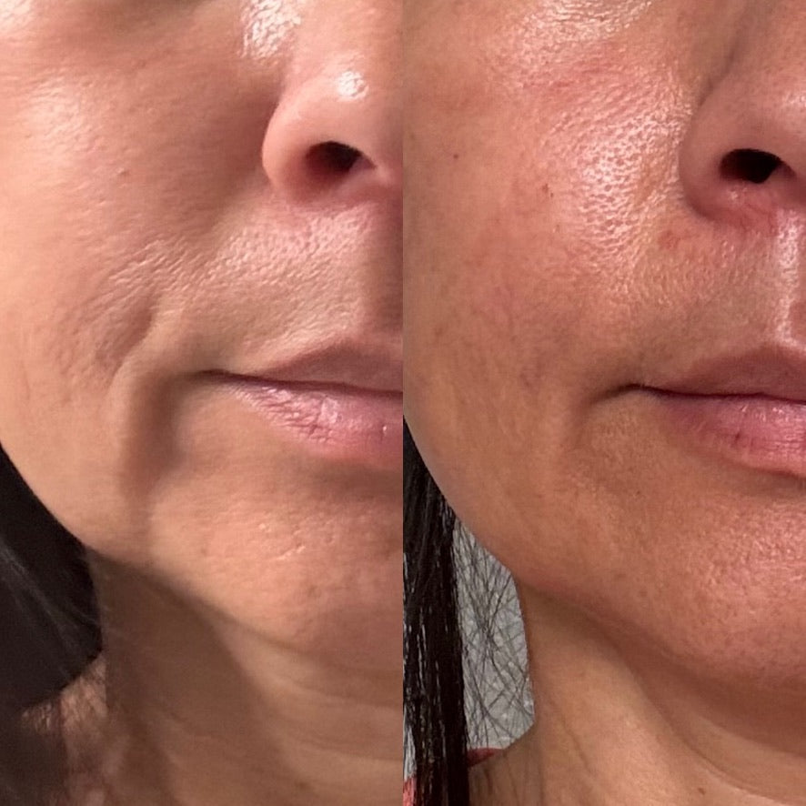 Collagen Cream Moisturizer