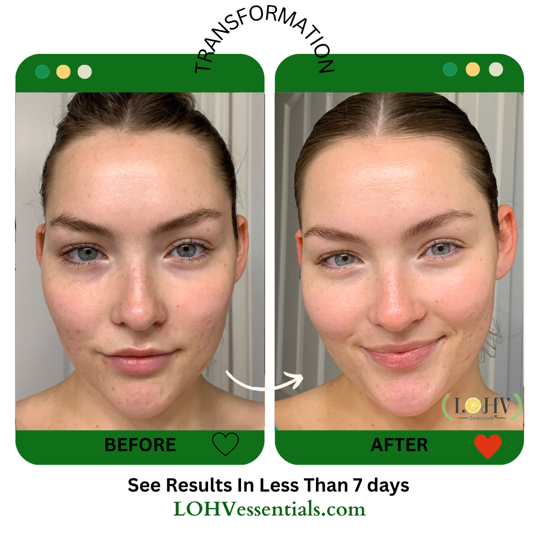 Hyper Hydrator Moisturizer – Vegan SPF 30 + Hyaluronic Acid
