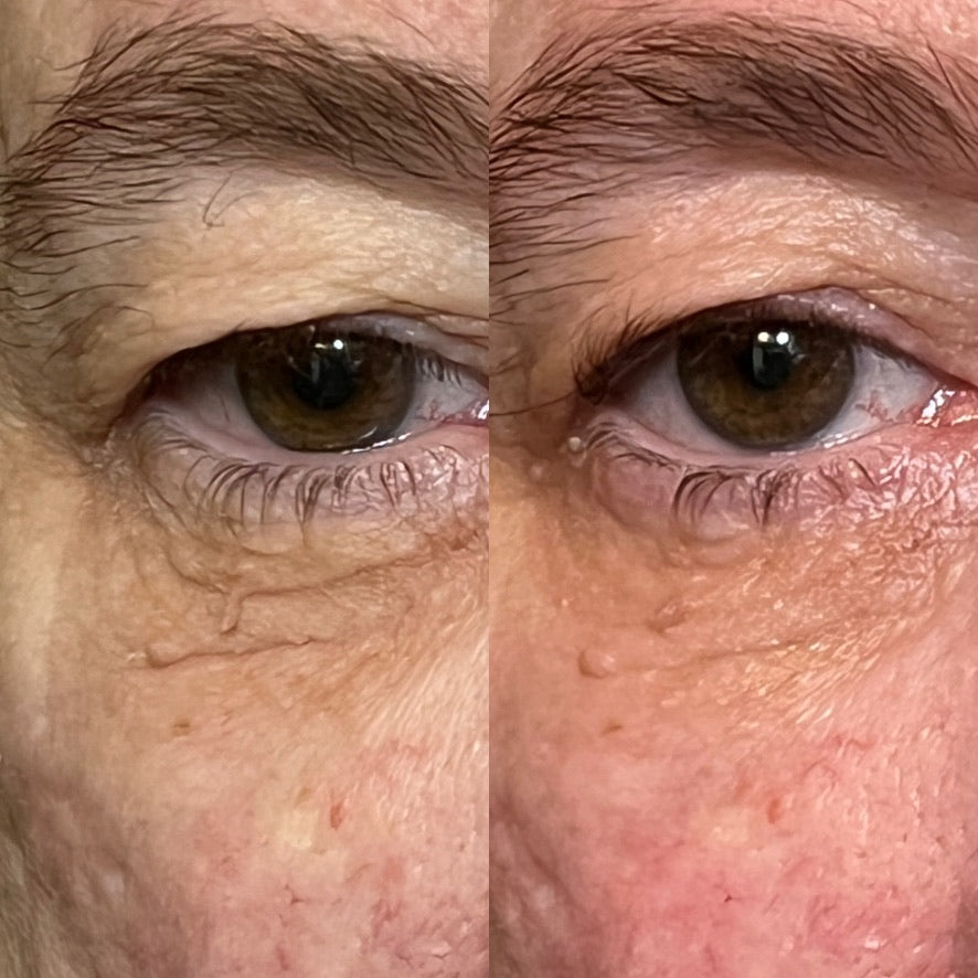 Collagen Cream Moisturizer