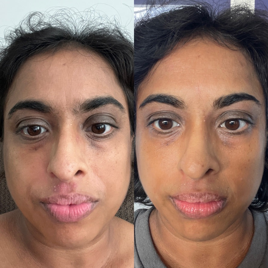 Collagen Cream Moisturizer