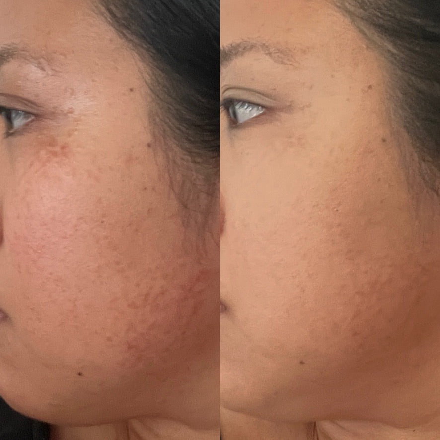 Holy GOAT Clarity Serum
