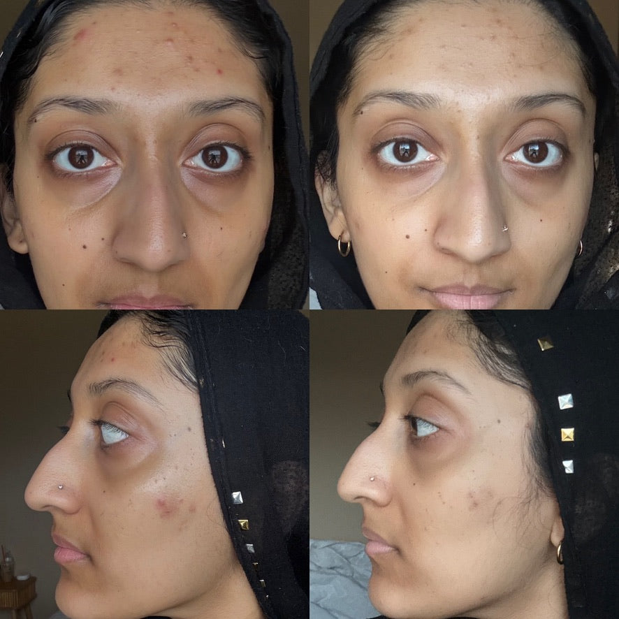 Holy GOAT Clarity Serum