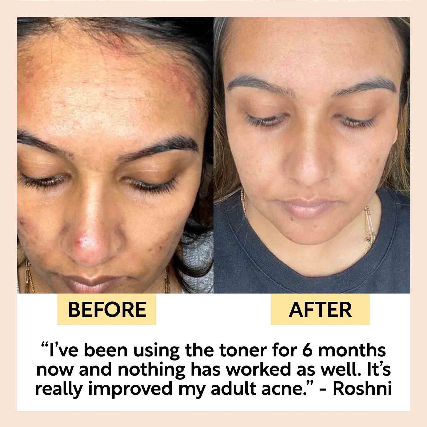 Face Toner with Hyaluronic Acid