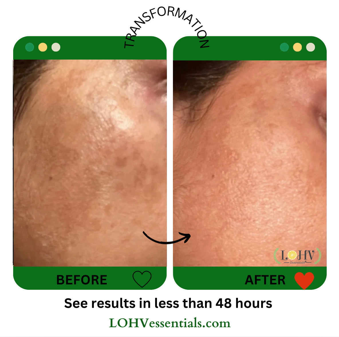 Glow Up Toner Serum – Vegan, Hyaluronic Acid + Niacinamide