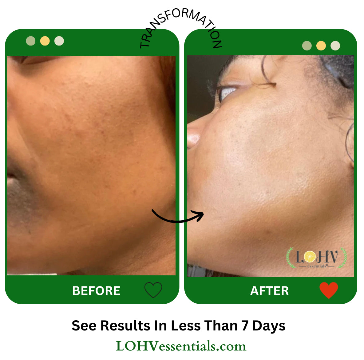 Glow Up Toner Serum – Vegan, Hyaluronic Acid + Niacinamide