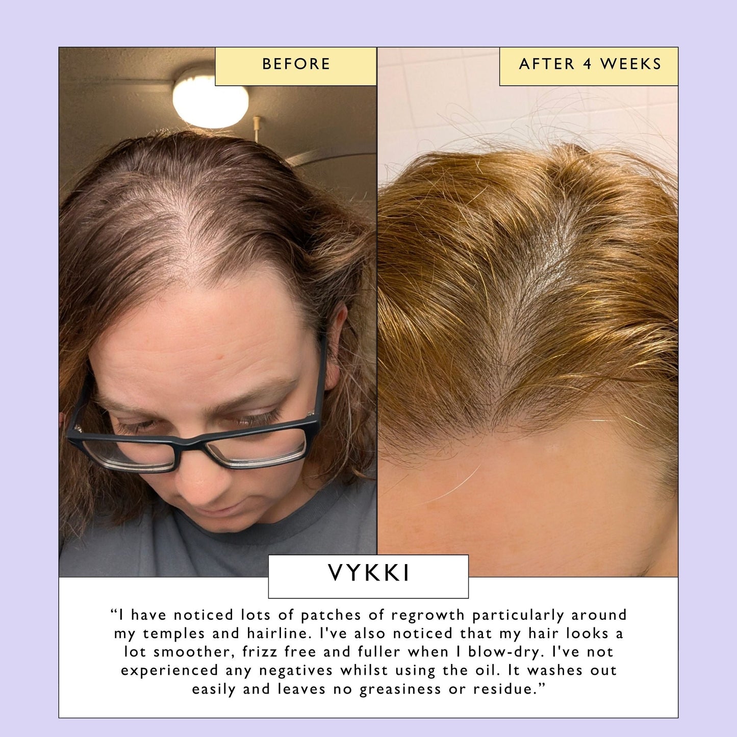 Scalp + Hair Oil with Bacuri Butter + Castor Oil