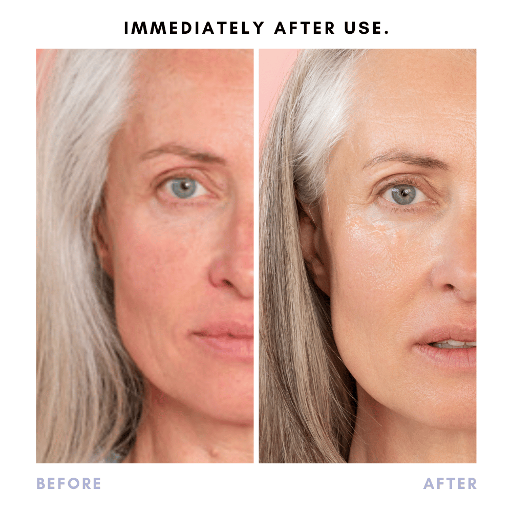 Sarah's Triple Threat | For Acne-Prone Maturing Skin