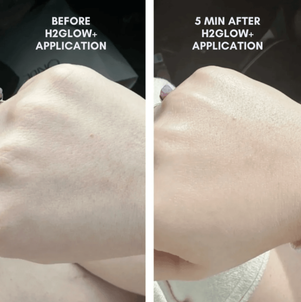 The Clear + Calm Skin Set Acne + Skin Barrier Support Essentials