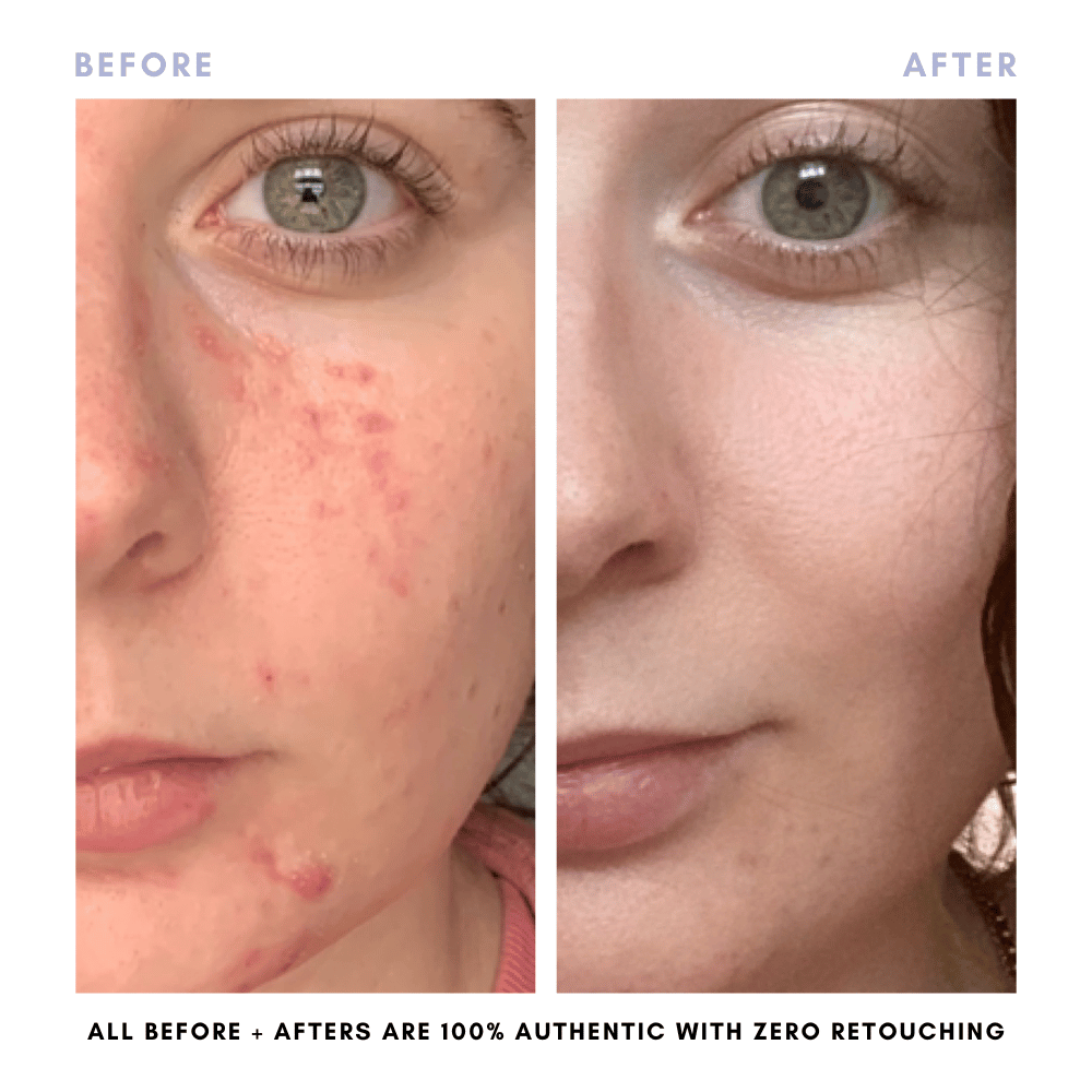 The Complete Skincare Collection