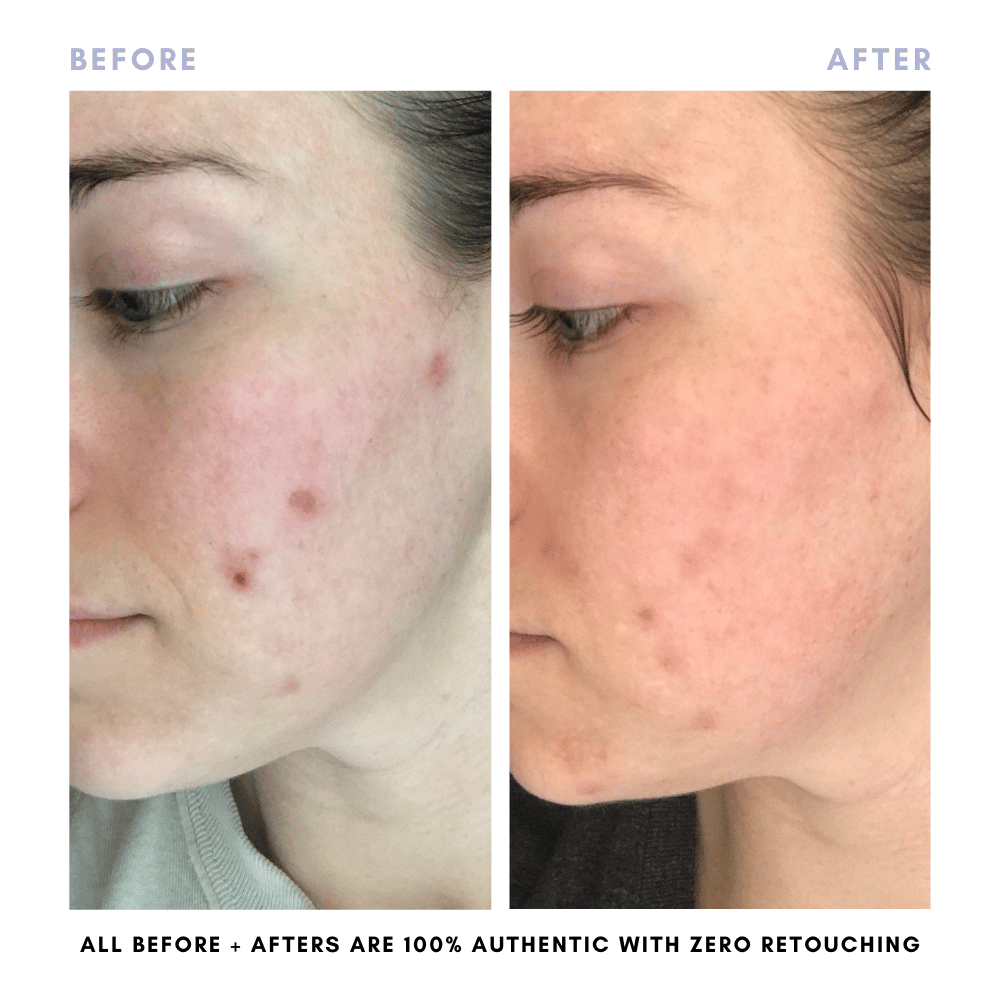 The Complete Skincare Collection