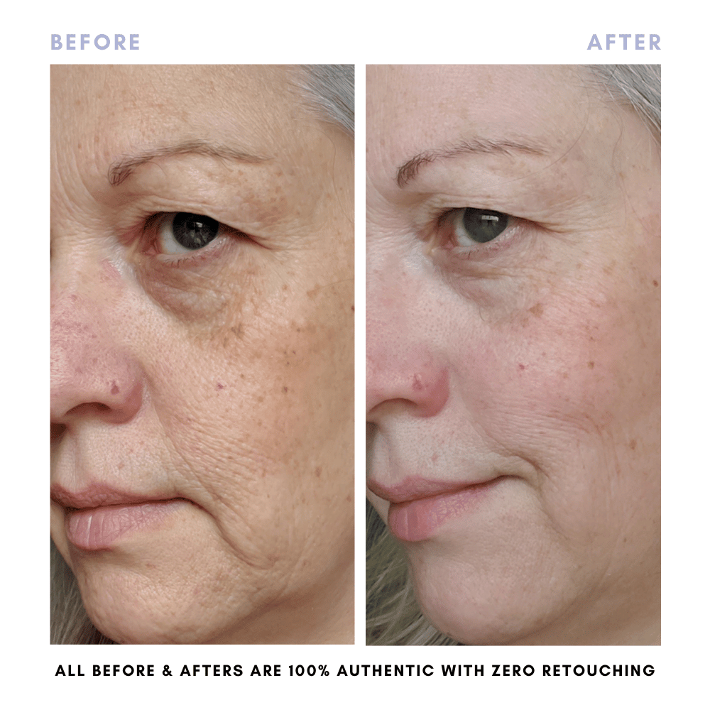 The Complete Skincare Collection