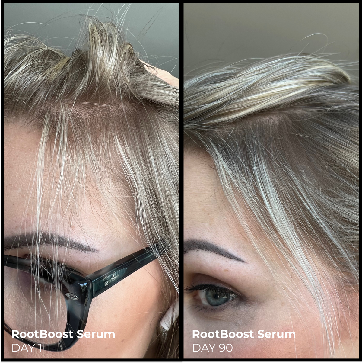 RootBoost Serum