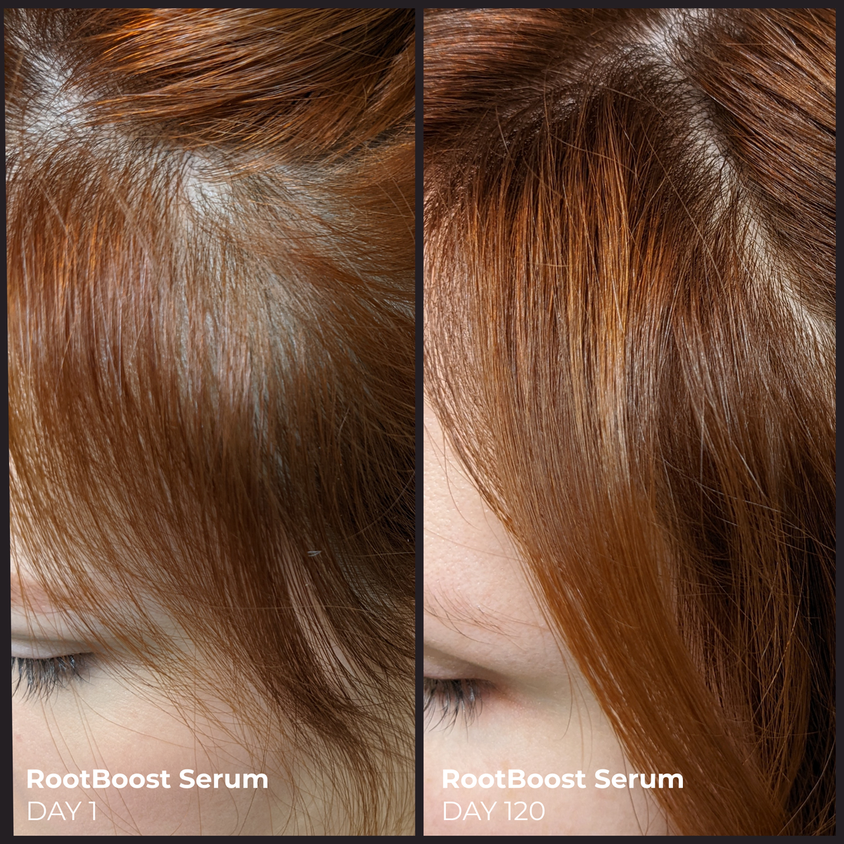 RootBoost Serum